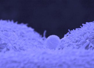 Exosomes are potential biomarkers for cancer progression and neurodegenerative disease