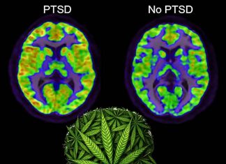Fatty acid amide hydrolase (FAAH) inhibitors may be helpful in the treatment of PTSD