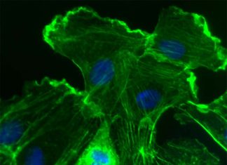 Fibroblast cells activate, divide and play key roles in both tissue repair and pathological scarring that can drive organ failure