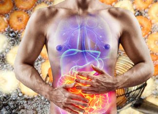 Frying oil consumption worsen colon cancer and colitis