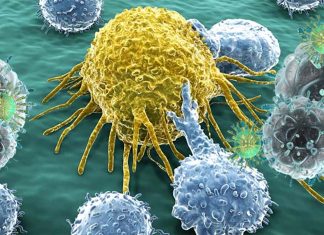 Immunotherapy is not effective in all patients and 70 percent to 80 percent don’t respond to treatment