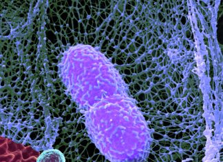 Scientists have produced and tested a vaccine that protects against Klebsiella pneumoniae
