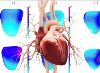 New MRI technique can measure strain in the heart without using gadolinium