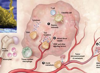 Most tumors contain macrophages that aid tumor growth