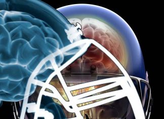 NFL players are at greater risk of developing cognitive problems and mental health issues