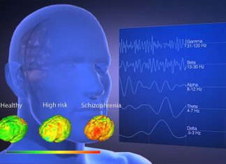 Rhythms in gene expression in the brain are highly disrupted in people with schizophrenia