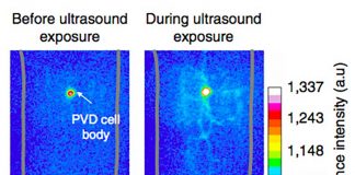 Sonogenetics can control neural activity by using sound frequencie