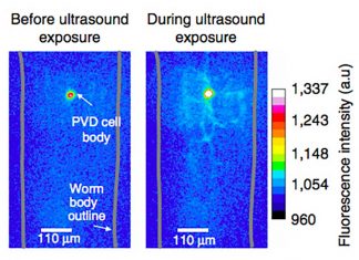 Sonogenetics can control neural activity by using sound frequencie