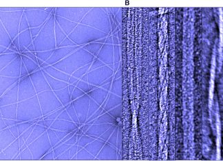 Alzheimer’s disease : new target for researches – the 23rd amino