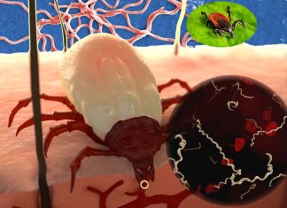 Researchers have discovered six candidate biomarkers for Lyme disease