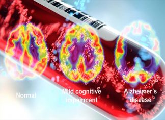 A new blood test for Alzheimer’s disease is up-to 94% accurate at predicting dementia before symptoms appear