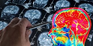 Non-invasive electrical stimulation as a novel therapeutic approach to brain tumors