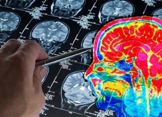 Non-invasive electrical stimulation as a novel therapeutic approach to brain tumors