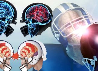 Former NFL players who received a concussion while playing are more likely to report low testosterone and erectile dysfunction
