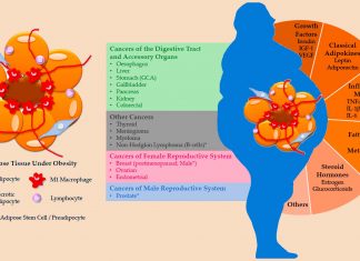 Scientists have demonstrated the link between high insulin levels and pancreatic cancer