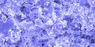 Bone tissue engineering (BTE) : hydroxyapatite (HA) for bone repair – induced antitumor effects