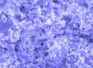 Bone tissue engineering (BTE) : hydroxyapatite (HA) for bone repair – induced antitumor effects