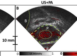 Newly devised hybrid camera captures molecular detail to detect cancer