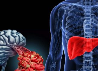 A link between liver dysfunction and Alzheimer’s disease has been discovered