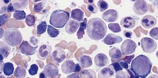 Researchers reprogramming adult cells from bone marrow so that they can be injected directly into a wound and grow into bone