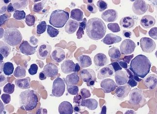 Researchers reprogramming adult cells from bone marrow so that they can be injected directly into a wound and grow into bone