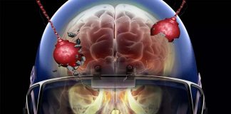 College football players : hits sustained from playing just one season cause structural changes to the brain
