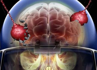 College football players : hits sustained from playing just one season cause structural changes to the brain