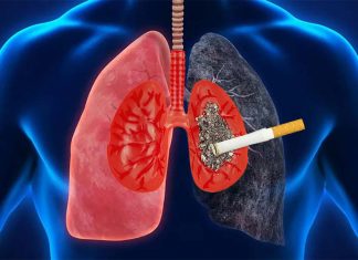 Comprehensive tobacco treatment can help cancer patients successfully quit and abstain from smoking