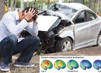 Development of the adolescent brain may play a critical role in involved in motor vehicle crashes