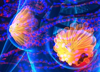 Researchers discovered that E-cadherin allows breast cancer cells to survive and promote metastasis