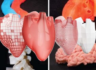 New technique called SWIFT allows 3D printing of large, vascularized human organ building blocks