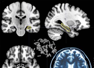 Telomere shortening is associated with gray matter reduction