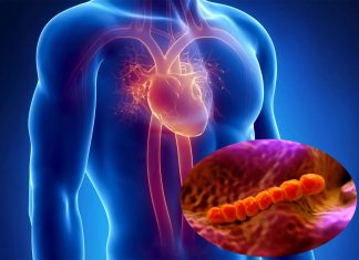 People with heart disease or defective or artificial heart valves are at increased risk of developing a potentially deadly valve infection