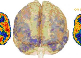 Chronic cocaine use alters the epigenetic profile of the FosB gene in the hippocampus