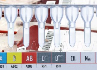 Laser-incubated immunohematological tests are faster and more sensitive than current best practice