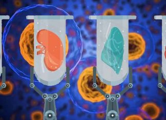 Researchers have developed a new method to transplant neural stem cells without the need of anti-rejection medications
