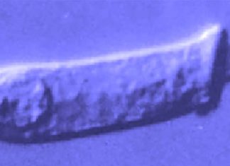 The ear’s tiny outer hair cells adjust the sensitivity to sound