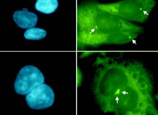 Researchers have demonstrated why chemotherapy drugs work better with some types of cancers than with others