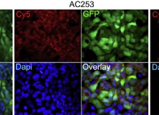 Researchers discovered a way to neutralize a rogue protein linked to Alzheimer’s disease