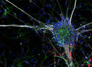 New imaging technique allows to view synaptic proteins at high resolution