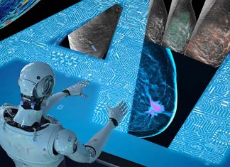 AI tool can identify breast cancer with 90 percent accuracy when combined with analysis by radiologists