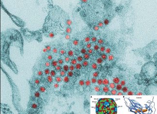 New discovery : Acute flaccid myelitis is caused by an enterovirus (EV) that invades and impairs the central nervous system