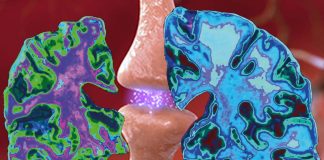 Alzheimer’s disease: where does it start?