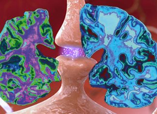 Alzheimer’s disease: where does it start?