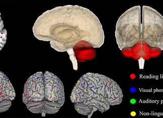 Cerebellum’s role cannot impact reading and Dyslexia
