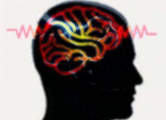 Deep brain stimulation (DBS) of the subcallosal cingulate (SCC) provides a robust antidepressant effect