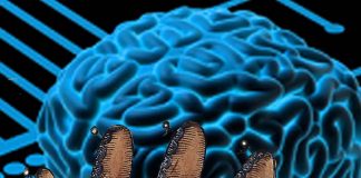 First bilateral implant plus brain-machine interface technology allow the controls of two prosthetic arms