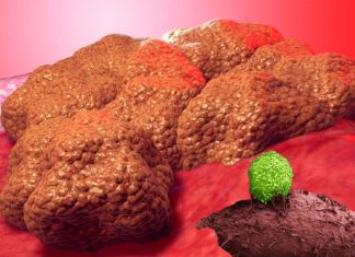 Hidden cancer cells : now scientists can make them stand out from the crowd