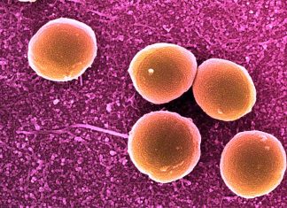 Immune cells in skin kill Staphylococcus aureus before they enter the body