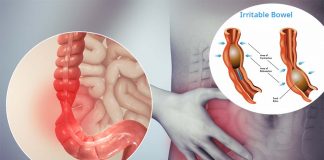 Hope for millions of Irritable Bowel Syndrome – researchers discovered receptors that cause gut itch